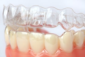 clear aligners atop a set of artificial teeth