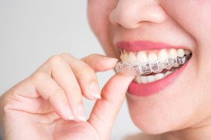 A smiling female placing a clear aligner into her mouth