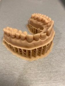3D printed tooth model