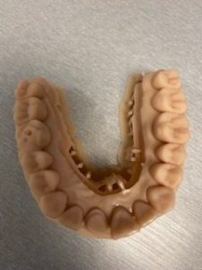3D printed human jaw model